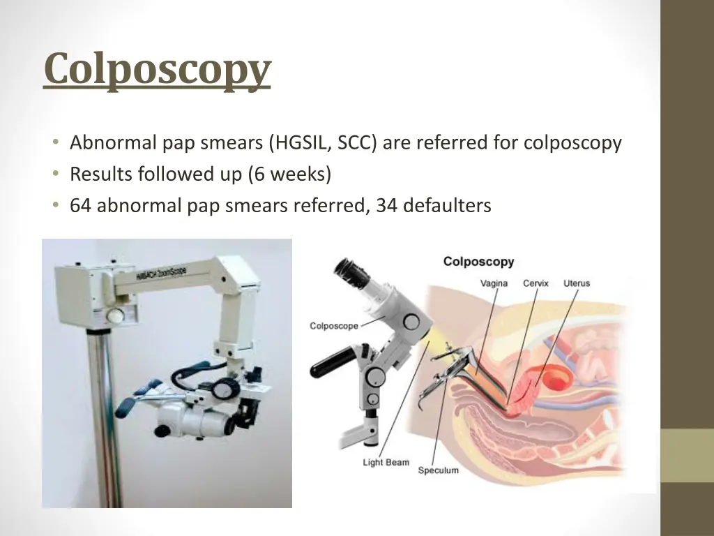 colposcopy