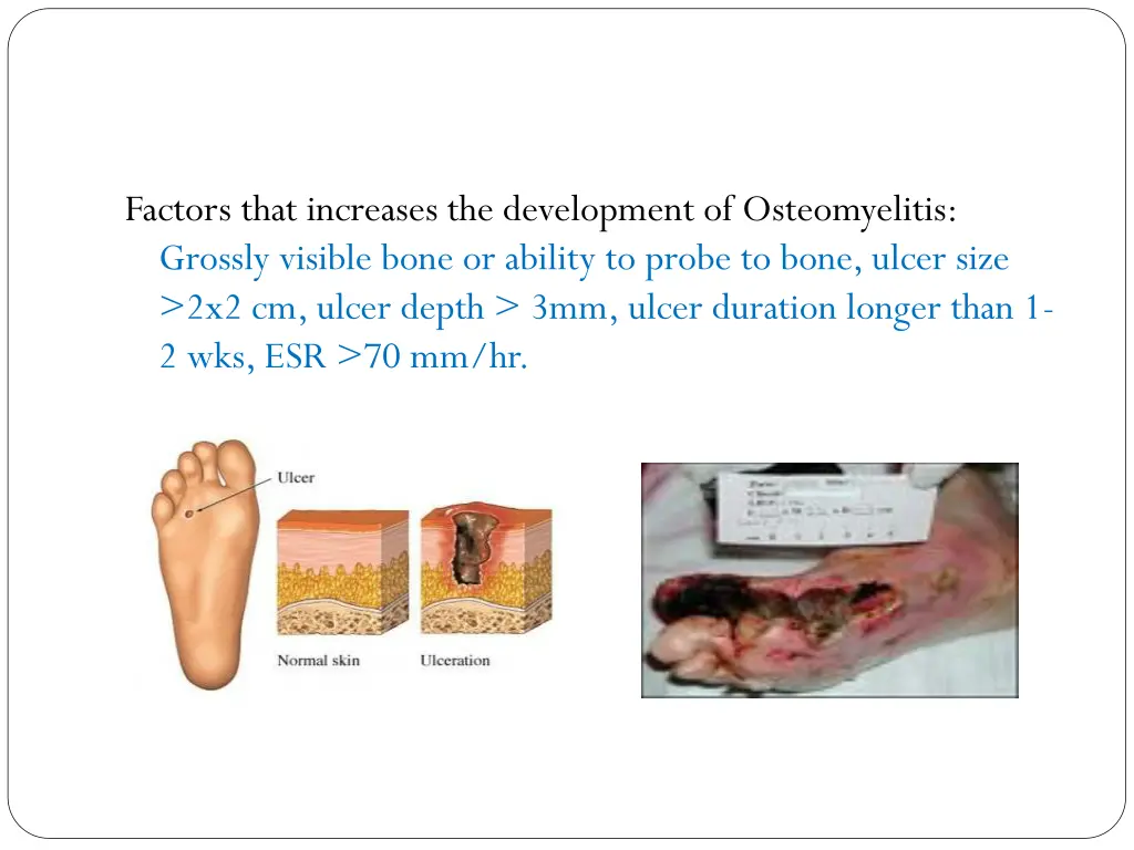 factors that increases the development