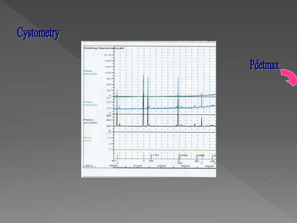 cystometry 1
