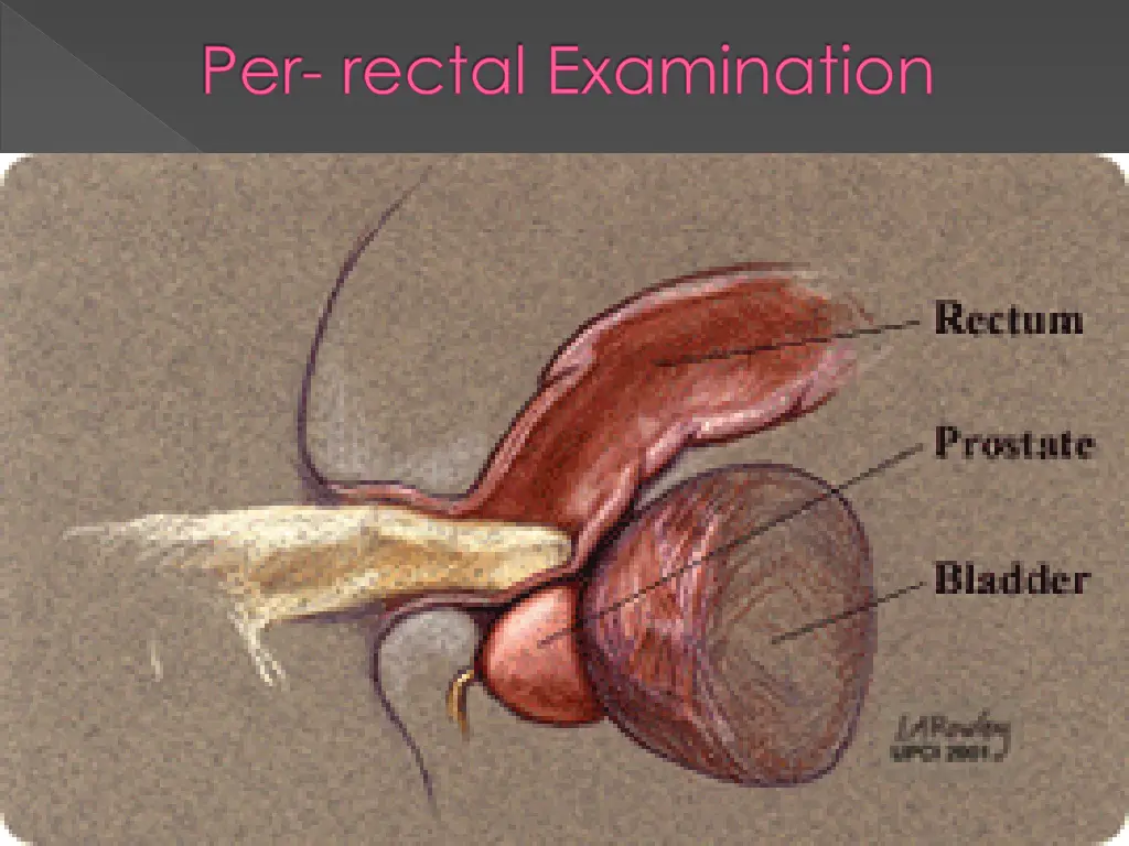 per rectal examination