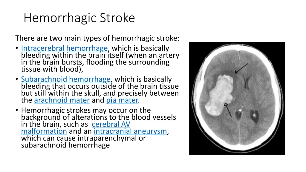 hemorrhagic stroke