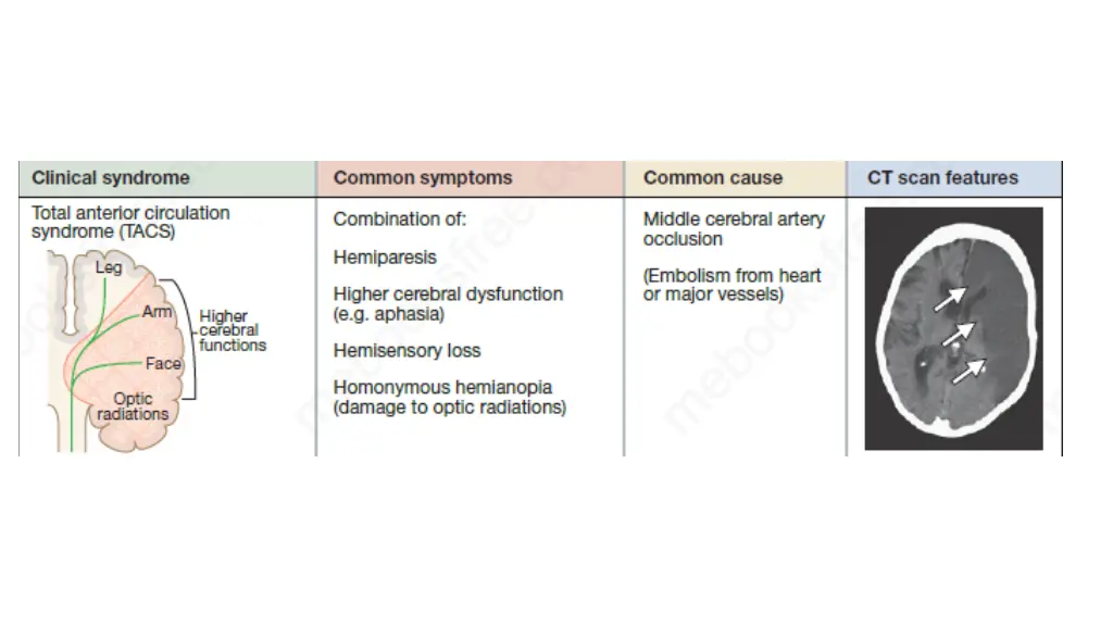slide13