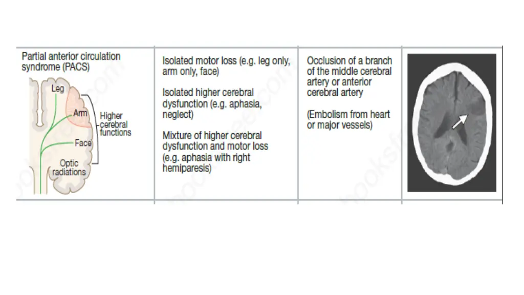slide14
