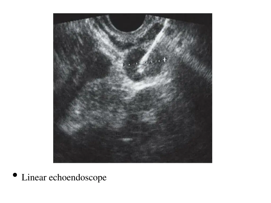 linear echoendoscope