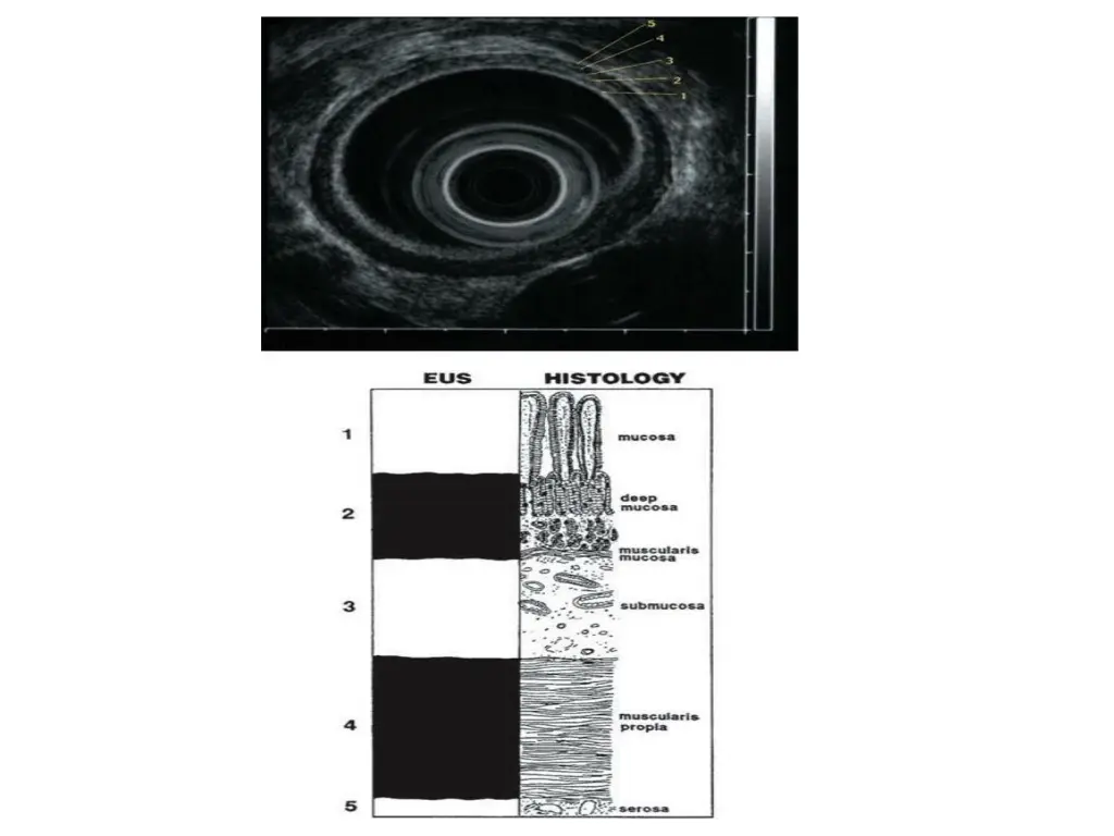 slide14