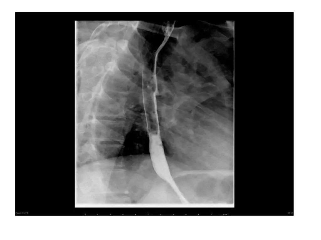 slide35
