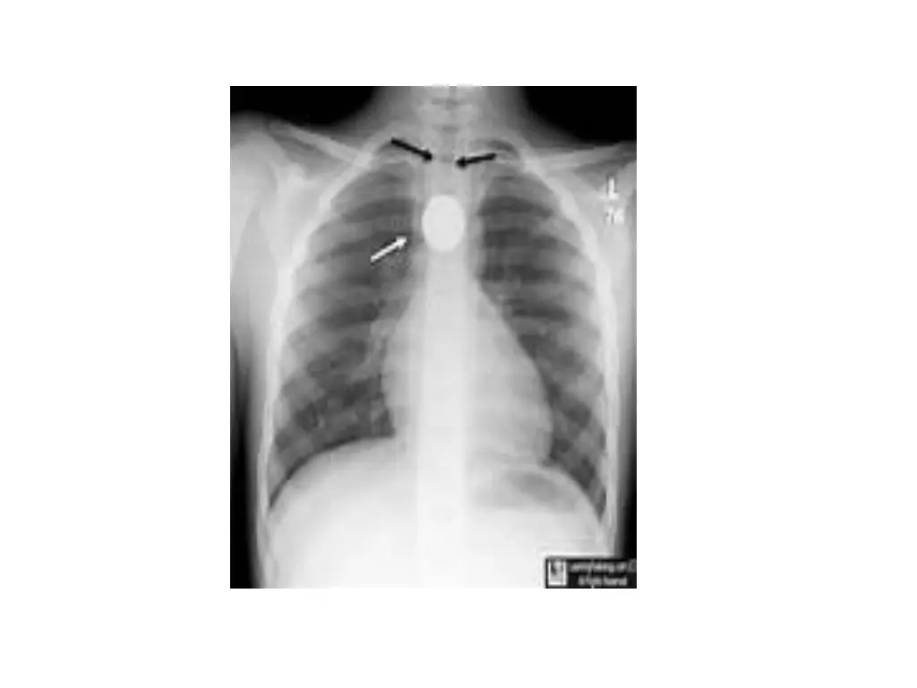 slide8
