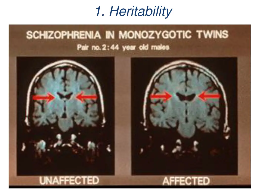 1 heritability 1