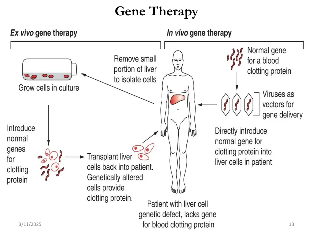 gene therapy