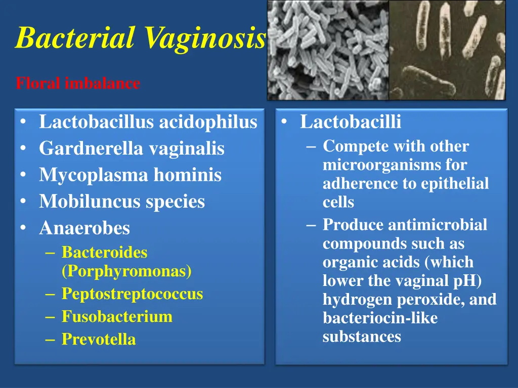 bacterial vaginosis