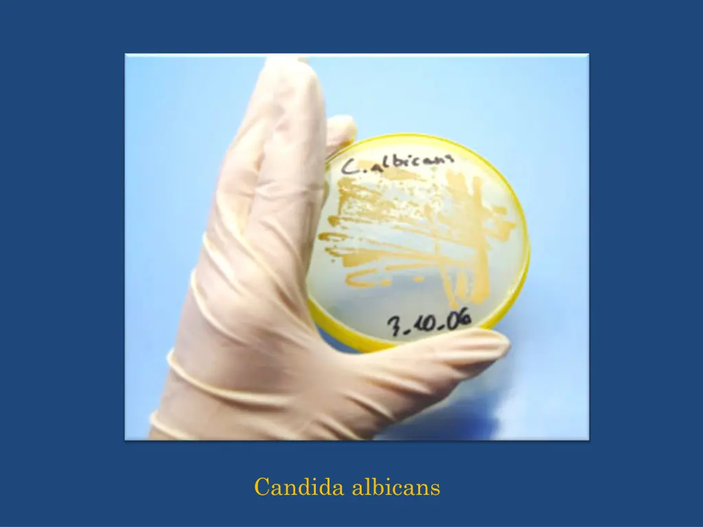candida albicans