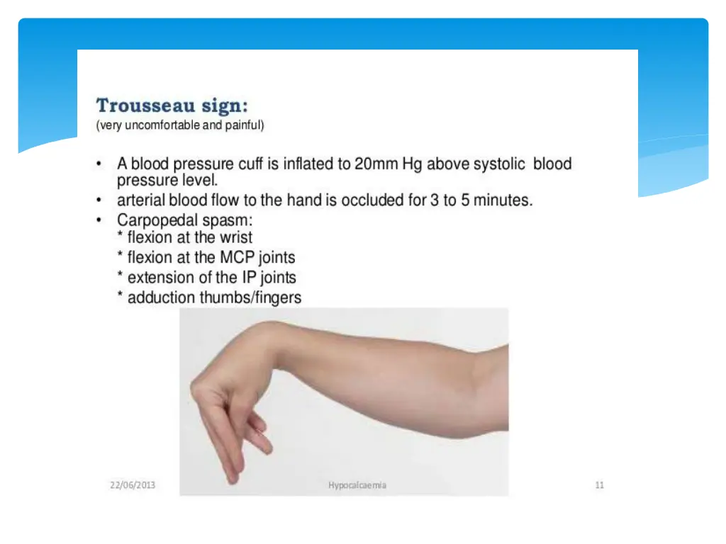 slide32