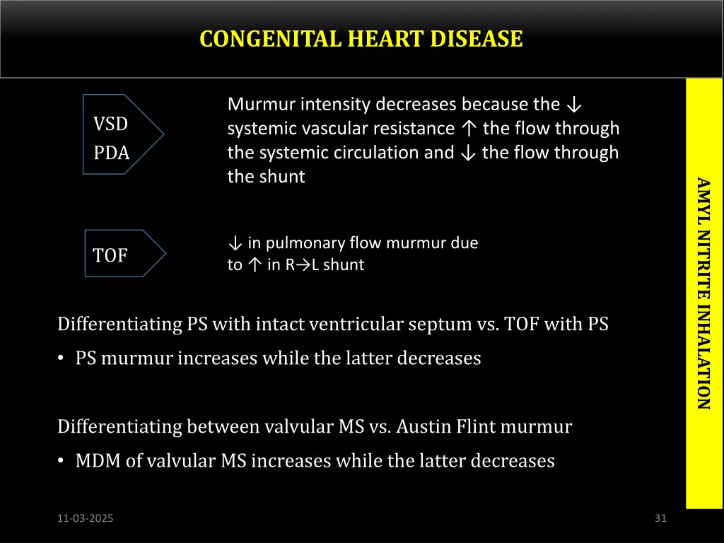 congenital heart disease