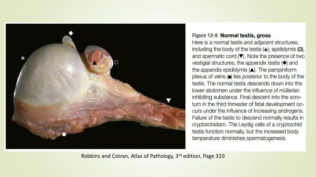 robbins and cotran atlas of pathology
