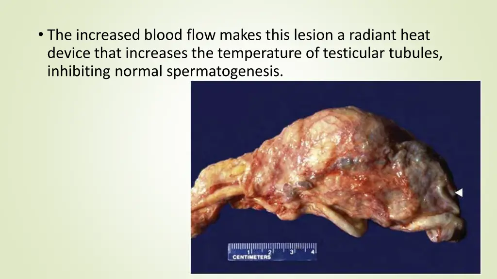 the increased blood flow makes this lesion