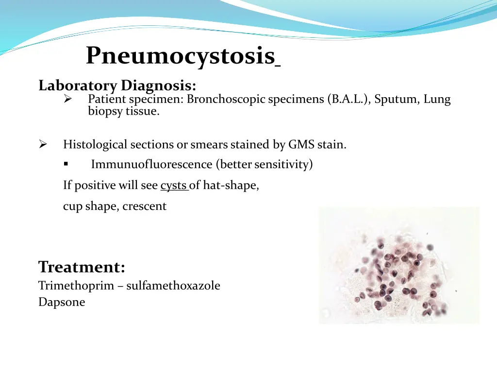 pneumocystosis