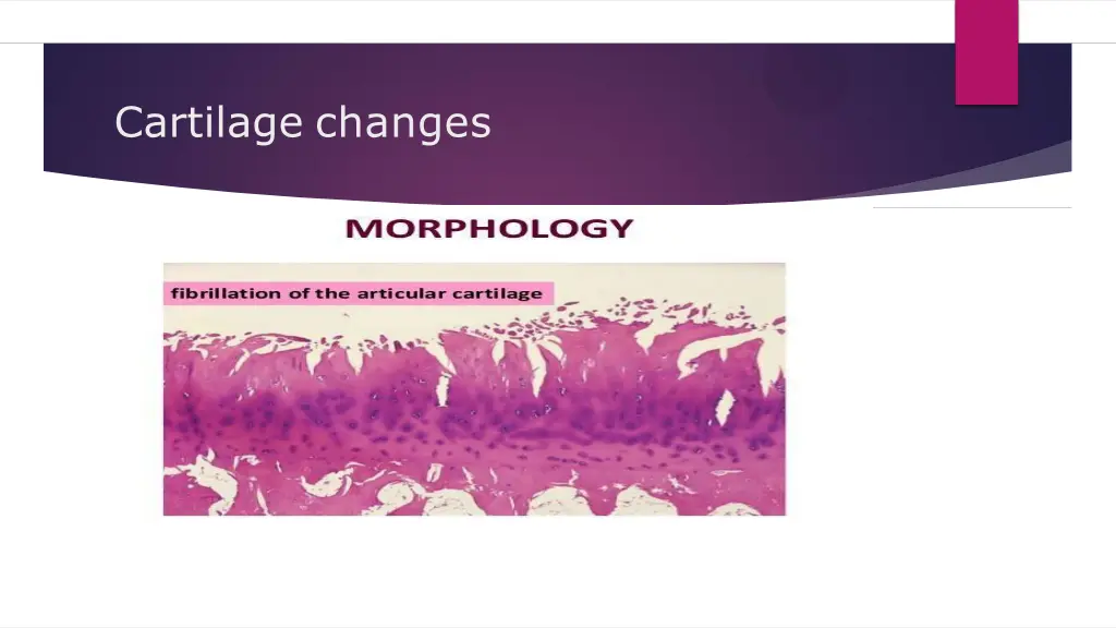 cartilage changes