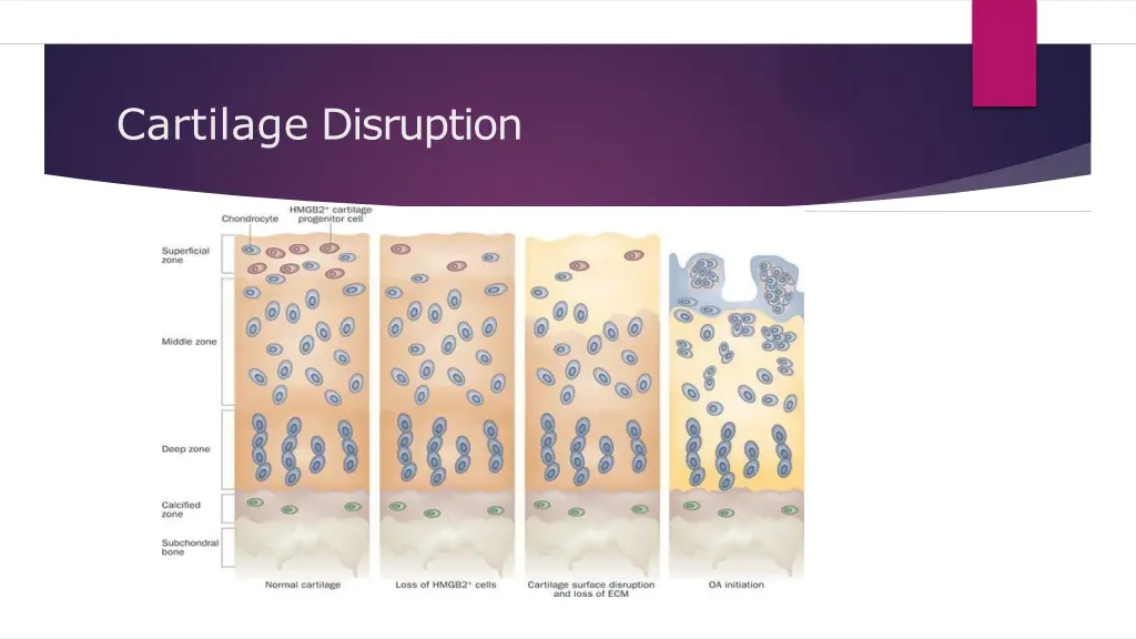 cartilage disruption