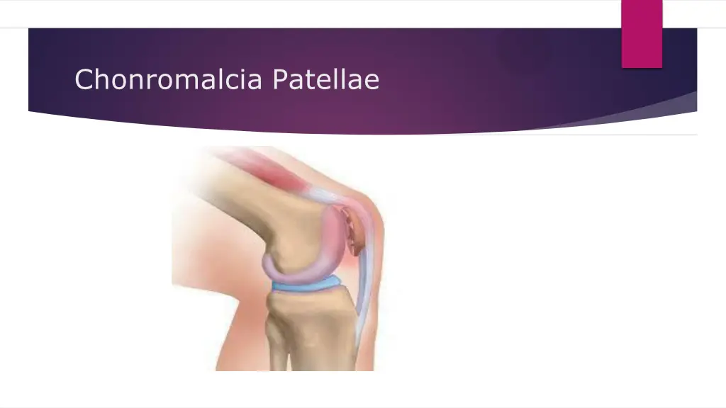 chonromalcia patellae