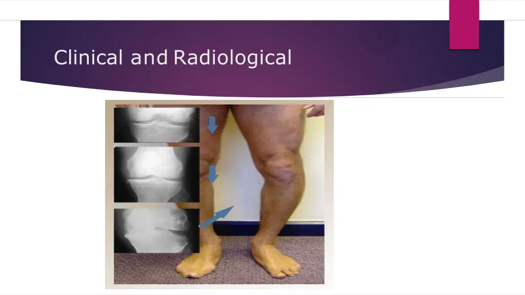 clinical and radiological