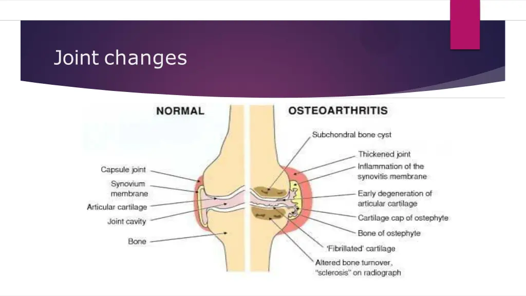 joint changes 1