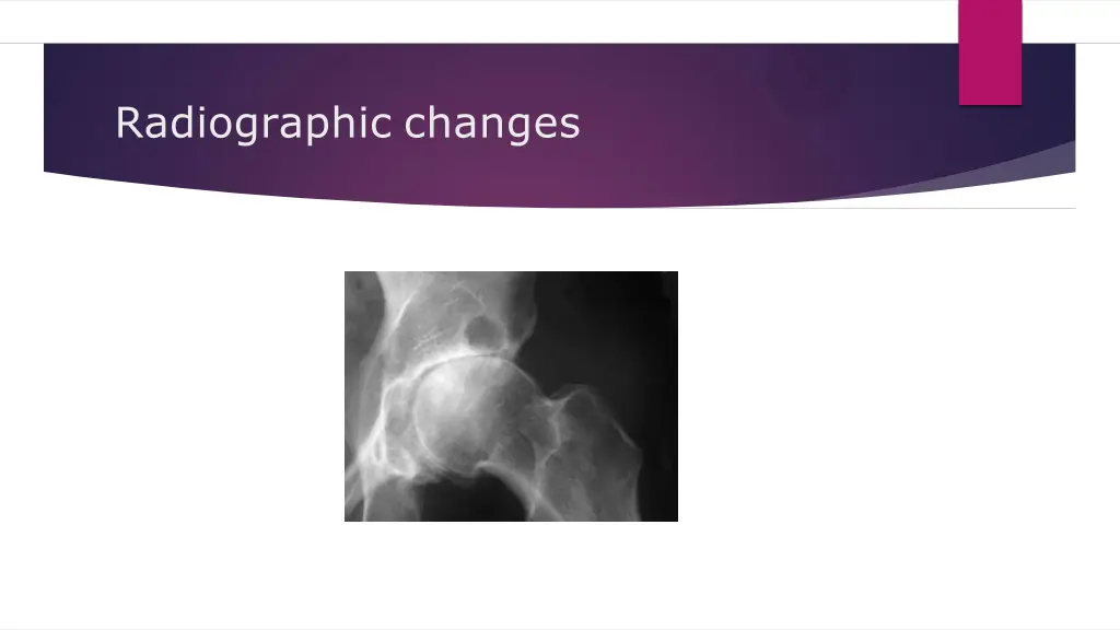 radiographic changes