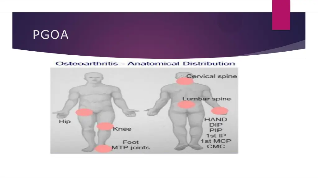 slide30