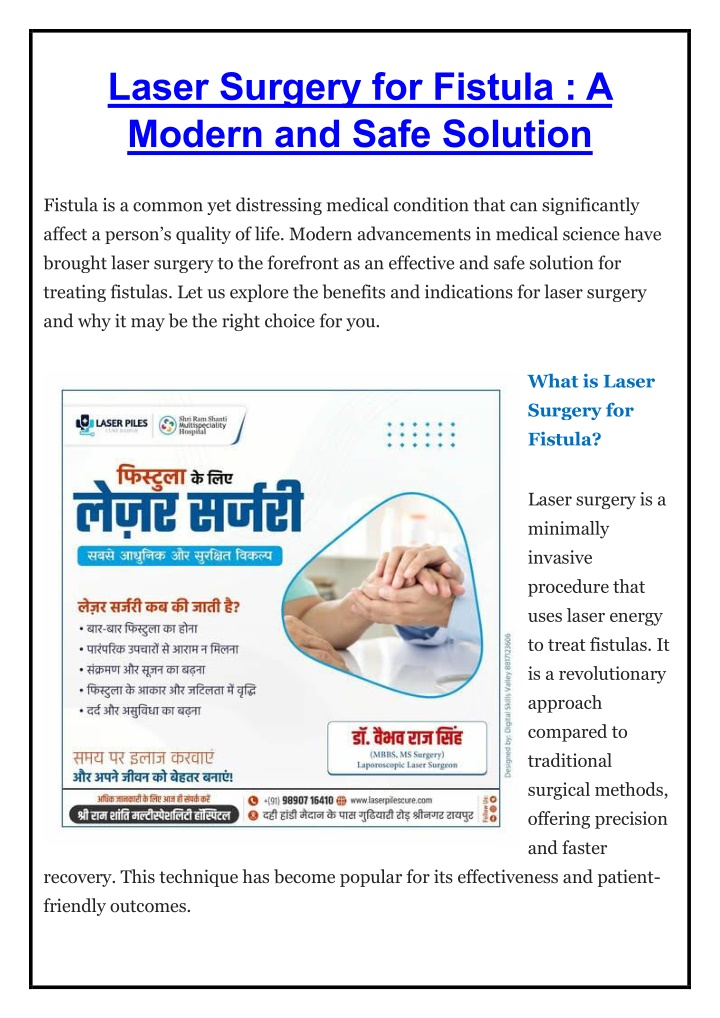laser surgery for fistula a modern and safe