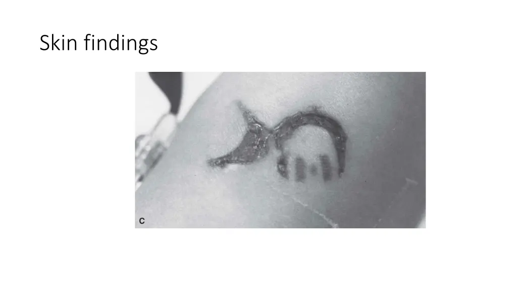 skin findings