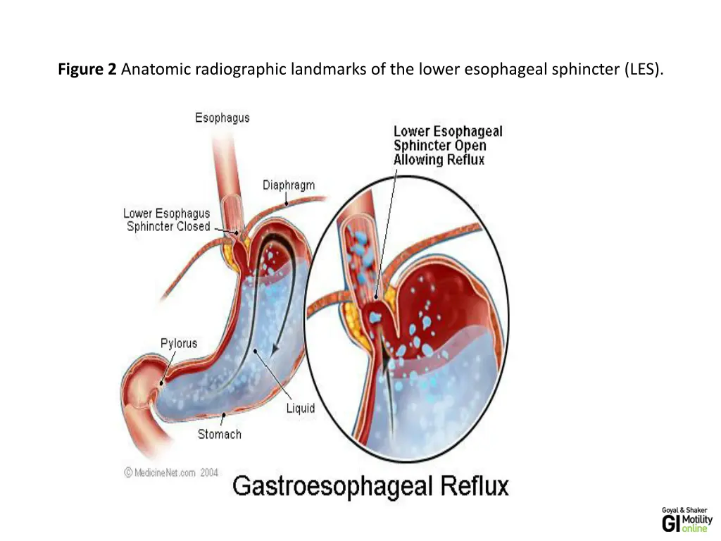 figure 2 anatomic radiographic landmarks
