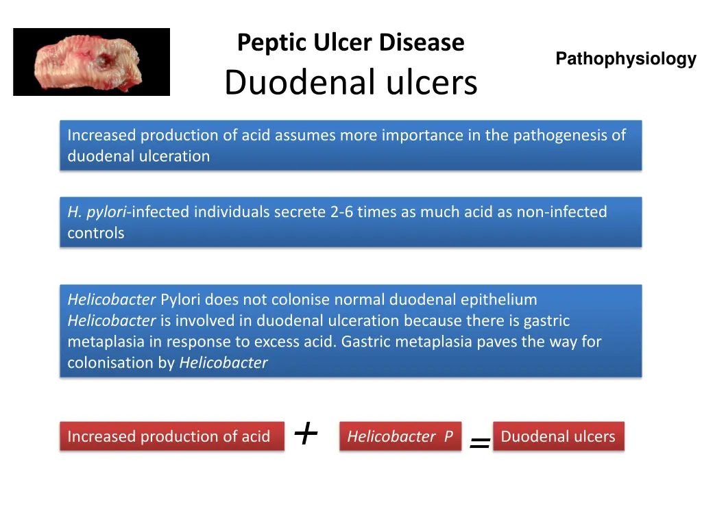 peptic ulcer disease duodenal ulcers