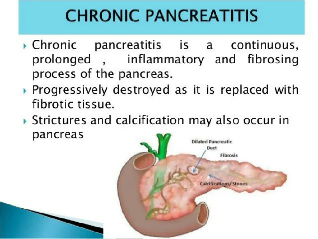 slide16