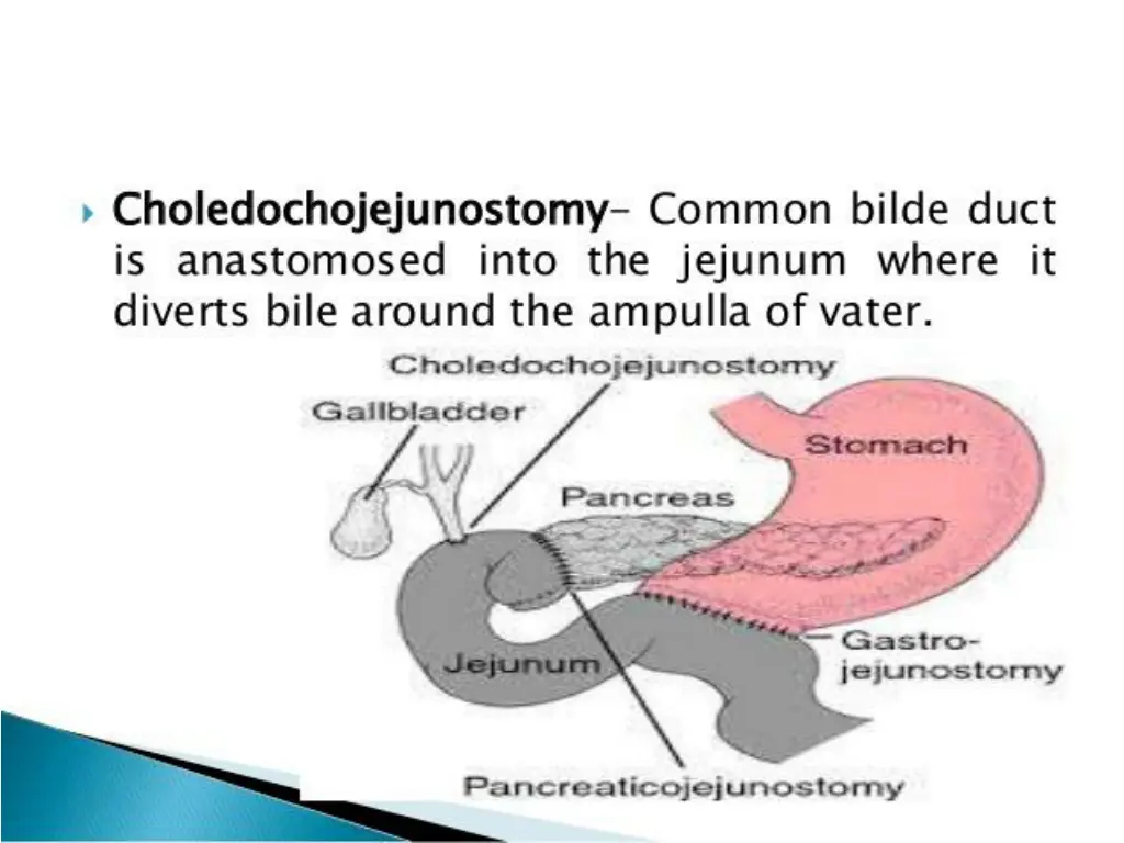 slide25