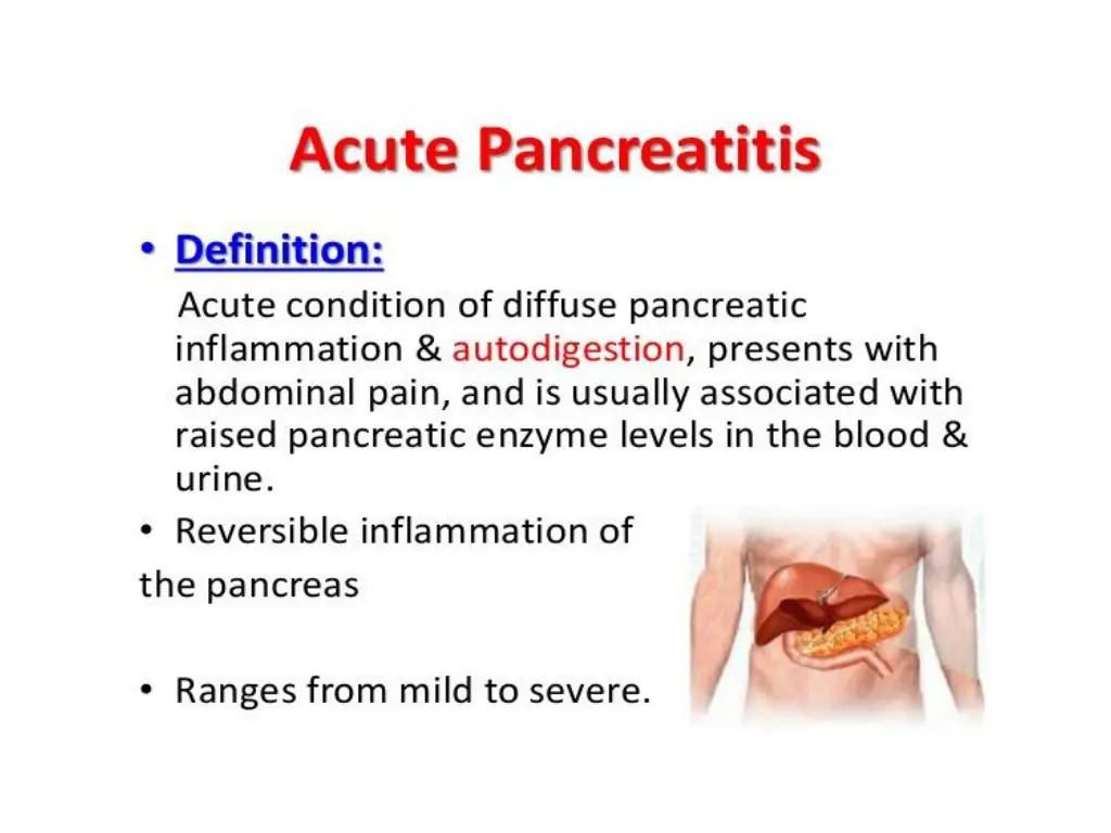 slide3