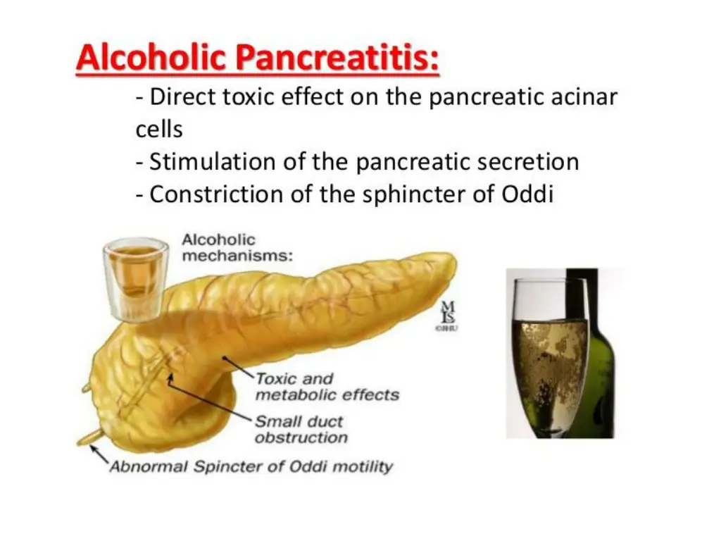 slide6
