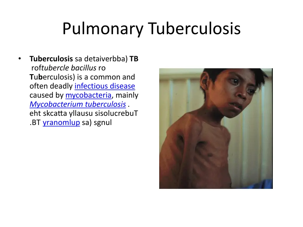 pulmonary tuberculosis 1