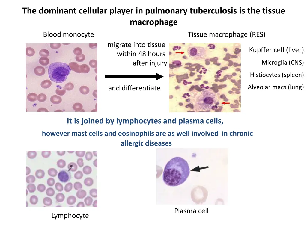 the dominant cellular player in pulmonary
