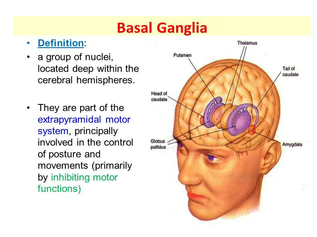 slide3
