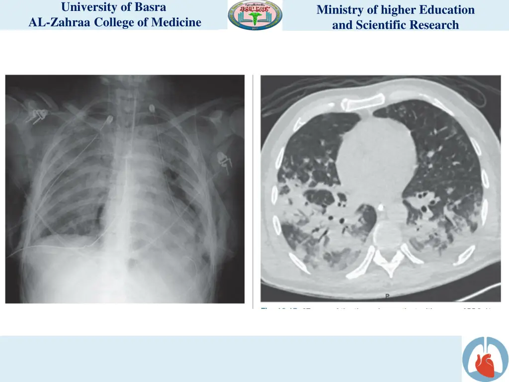 university of basra al zahraa college of medicine 9