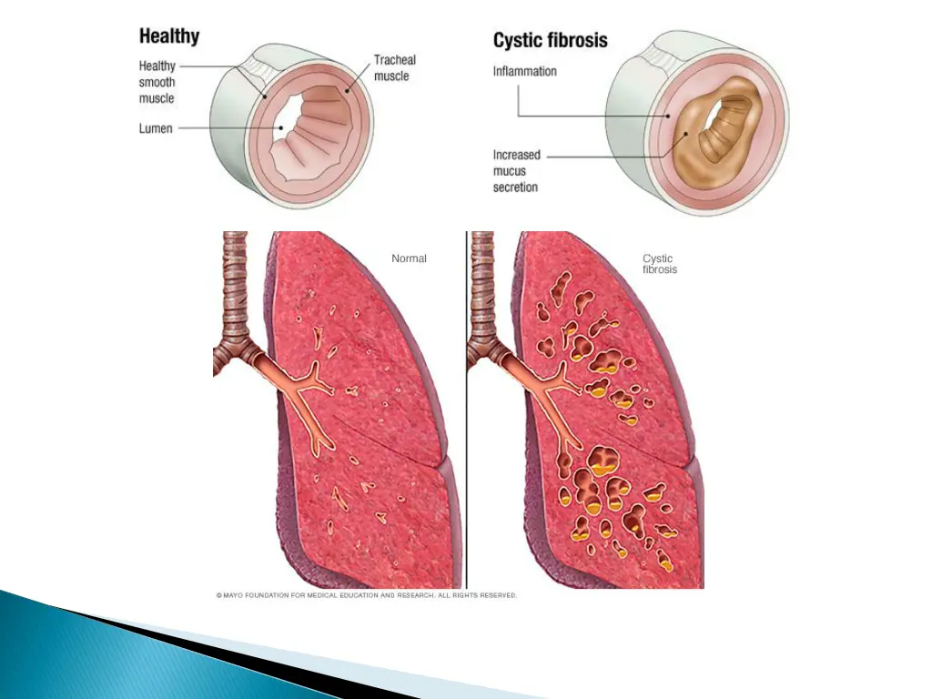 slide16