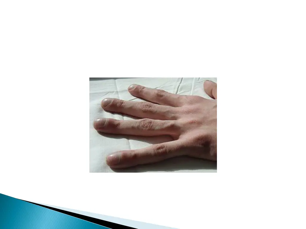 slide17