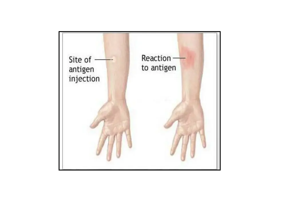 slide5