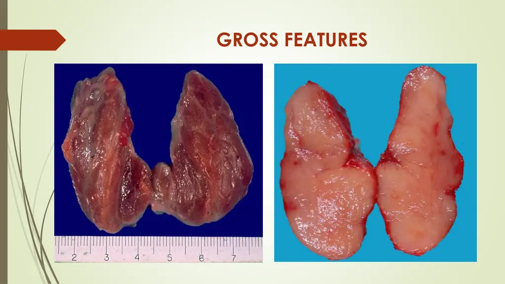 gross features