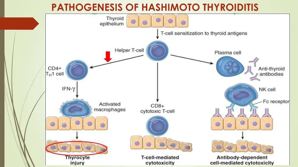 pathogenesis of hashimoto thyroiditis