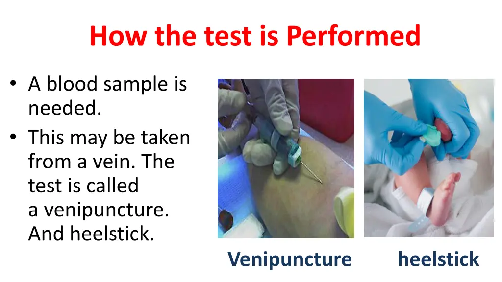 how the test is performed