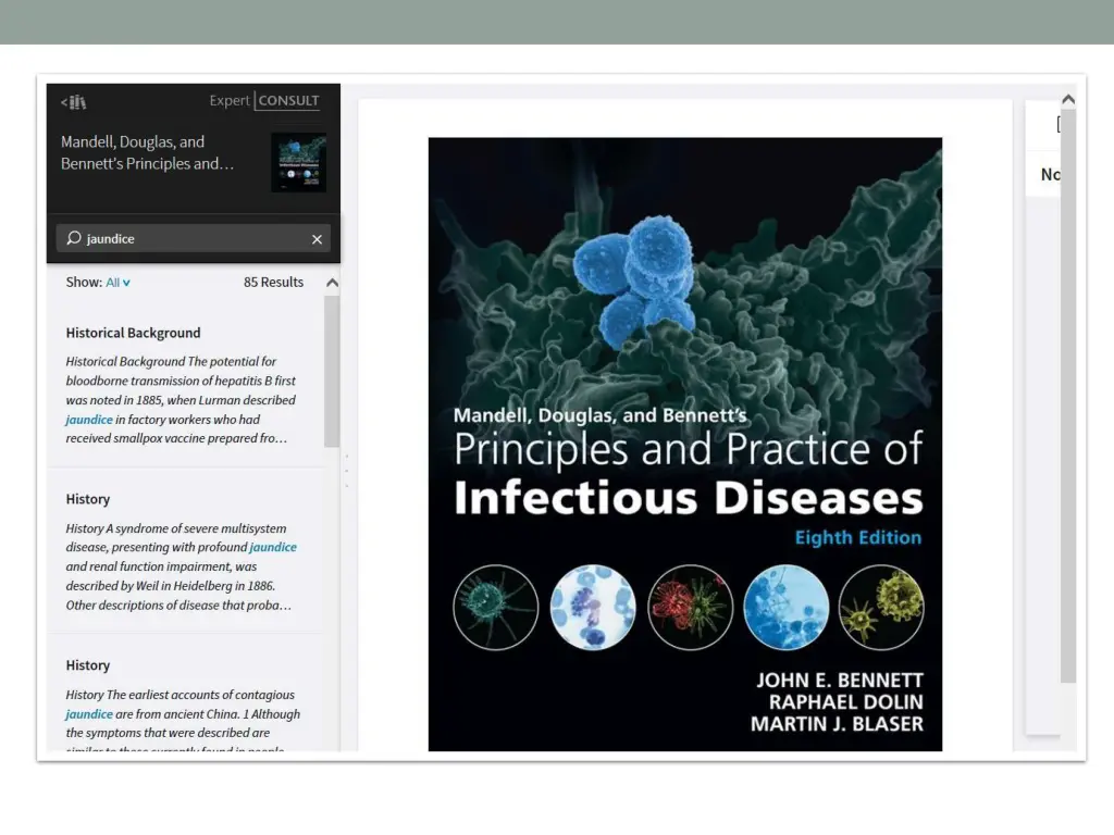 slide12