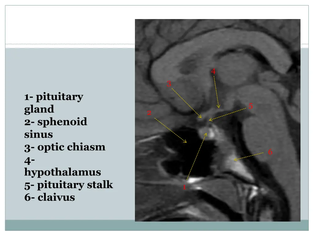 slide14