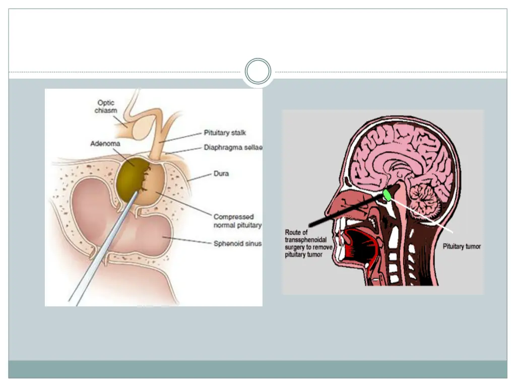 slide20