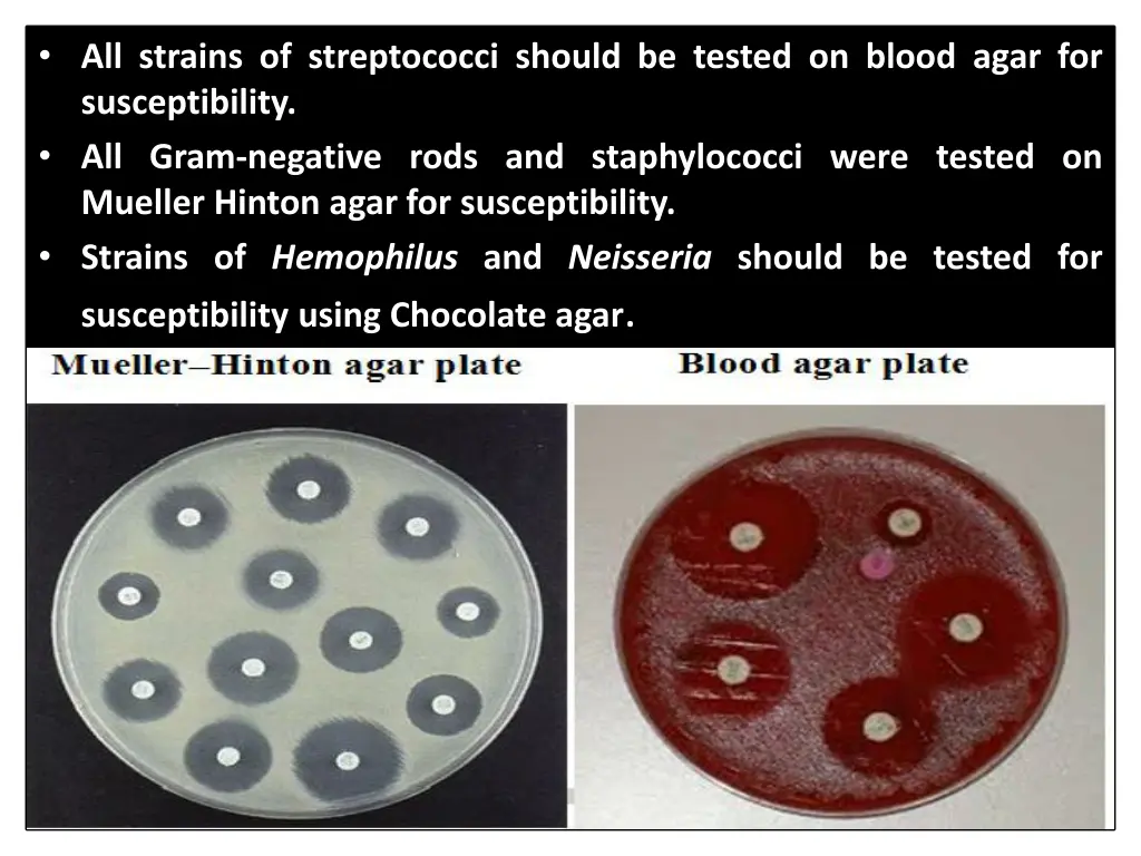 all strains of streptococci should be tested