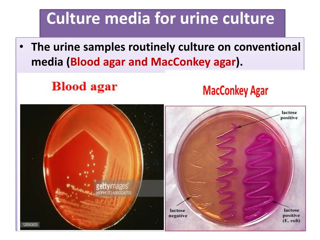 culture media for urine culture